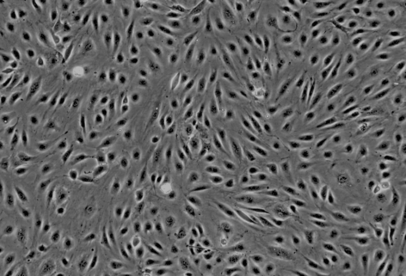 Jurkat（clone E6-1）人T淋巴细胞白血病细胞