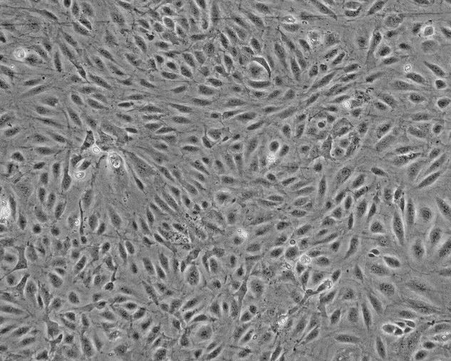 HFOB1.19人SV40转染成骨细胞