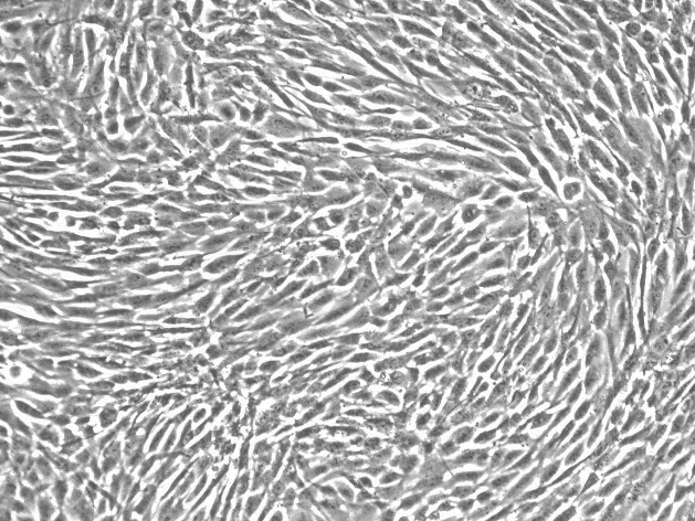 CAOV-3人乳头状卵巢腺癌细胞