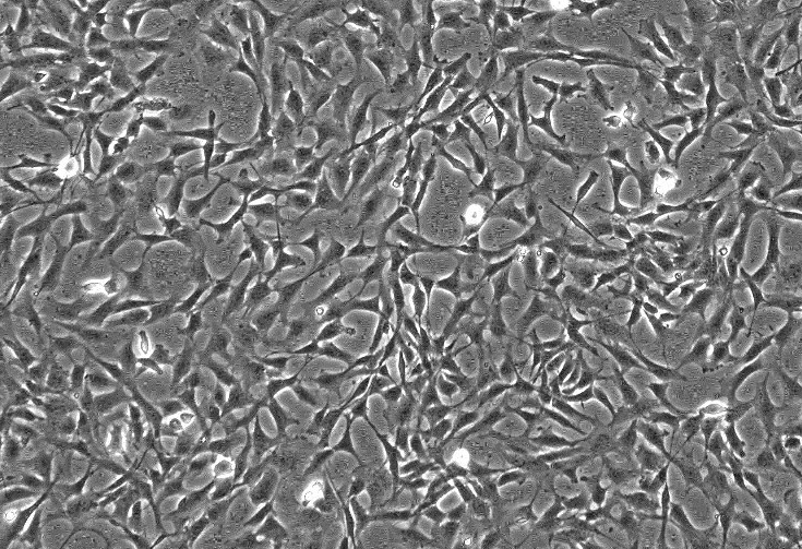 MC38小鼠结肠癌细胞