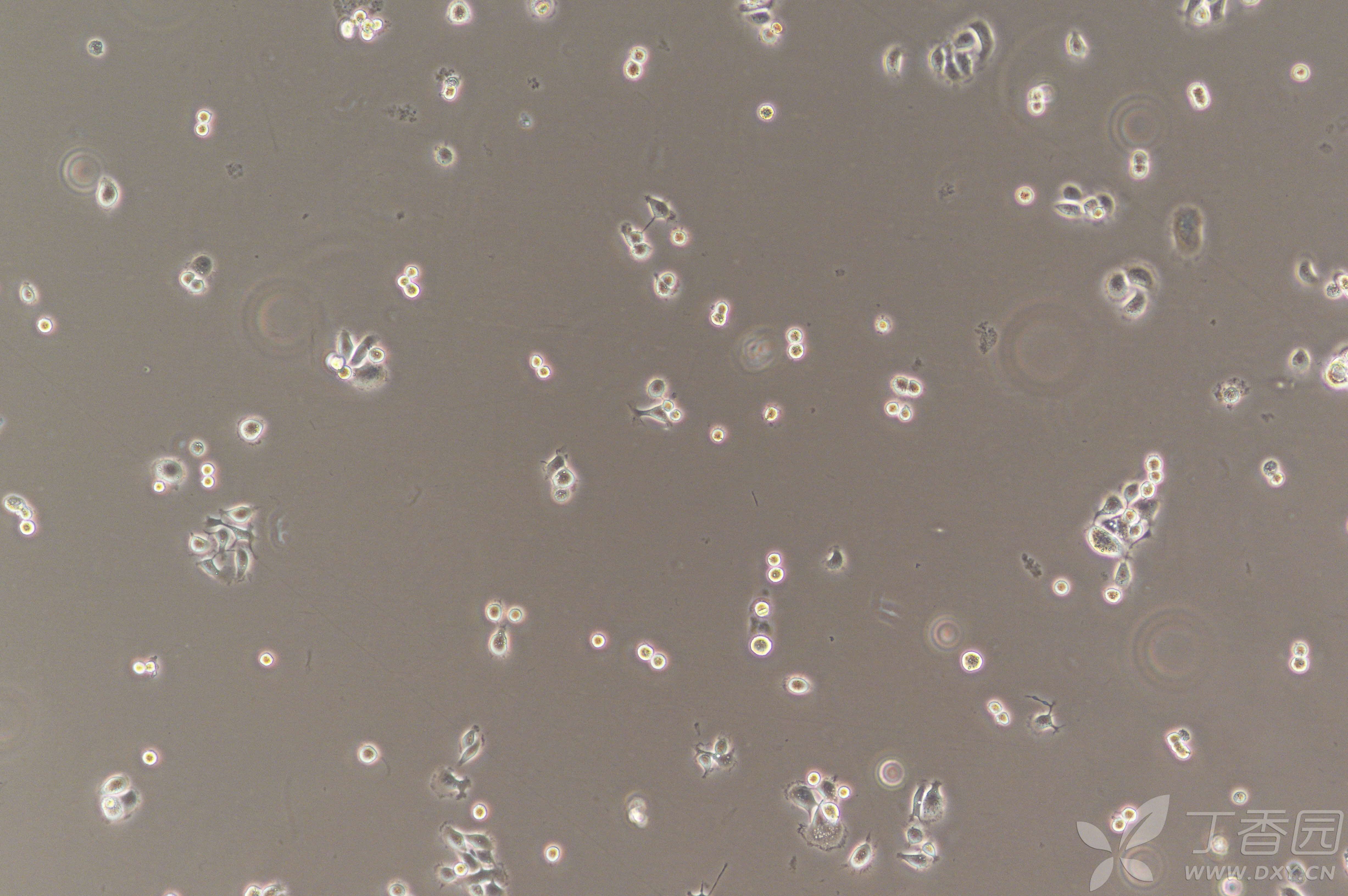 16hbe细胞突然多了很多悬浮黑点!求小伙伴救救孩子!