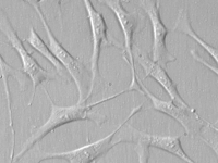 人心肌成纤维细胞