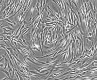 人血管内皮细胞