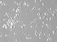 Hepa 1-6小鼠肝癌细胞