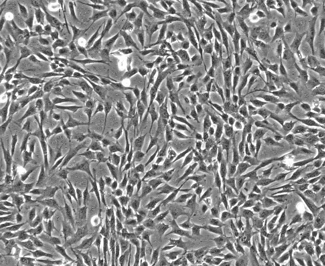 BALB/3T3 clone A31小鼠胚胎成纤维细胞