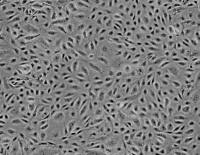CNE1-LUC人鼻咽癌细胞-荧光素酶标记