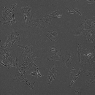 間充質干細胞-MSCs