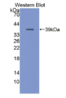 NADH脱氢酶1(ND1)多克隆抗体