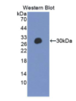 非受体型蛋白酪氨酸磷酸酶14(PTPN14)多克隆抗体