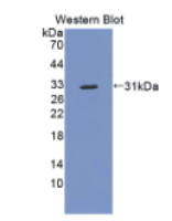 结合珠蛋白(Hpt)多克隆抗体
