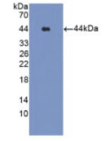 谷氨酰胺合成酶(GS)多克隆抗体
