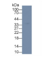 白介素1β(IL1b)多克隆抗体