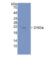 肌红蛋白(MYO)多克隆抗体