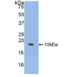 白介素1受体拮抗剂(IL1RA)多克隆抗体
