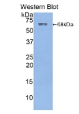 白蛋白(ALB)多克隆抗体
