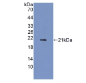 脂联素受体2(ADIPOR2)多克隆抗体