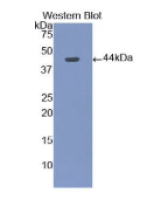 胃泌素(GT)多克隆抗体