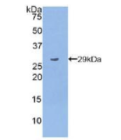 多聚ADP核糖聚合酶(PARP)多克隆抗体