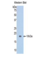 脑膜瘤表达抗原5(MGEA5)多克隆抗体
