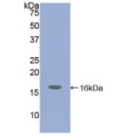 胰岛素样生长因子1(IGF1)多克隆抗体