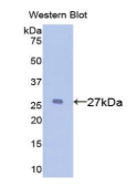 α1-B-糖蛋白(a1BG)多克隆抗体