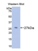 α1-B-糖蛋白(a1BG)多克隆抗体