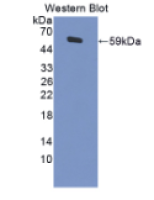 活性依赖性神经保护因子(ADNP)多克隆抗体