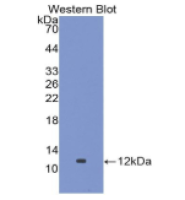谷丙转氨酶2(ALT2)多克隆抗体