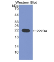 CD276分子(CD276)多克隆抗体