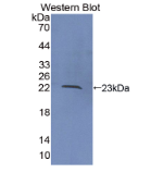 ⅩⅥ型胶原(COL16)多克隆抗体