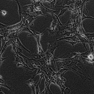 恶性胶质瘤细胞-U87MG