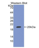 RNA结合基元蛋白20(RBM20)多克隆抗体