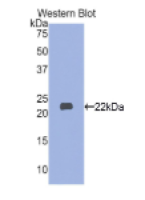 肌球蛋白轻链3(MYL3)多克隆抗体