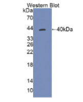 硫代硫酸盐转硫酶(TST)多克隆抗体