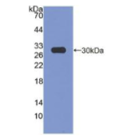3-羟基3-甲基戊二酰辅酶A还原酶(HMGCR)多克隆抗体