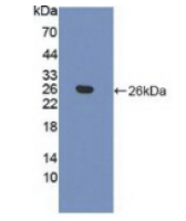 载脂蛋白B(APOB)多克隆抗体