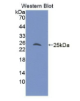 雄激素受体(AR)单克隆抗体