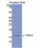 三叶因子2(TFF2)单克隆抗体