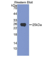 头蛋白(NOG)单克隆抗体