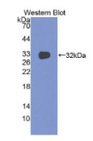 组织因子(TF)单克隆抗体