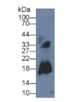 核糖核酸酶A2(RNASE2)单克隆抗体