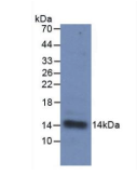 白介素33(IL33)单克隆抗体