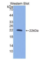 白介素10(IL10)单克隆抗体
