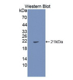 白介素1α(IL1a)单克隆抗体