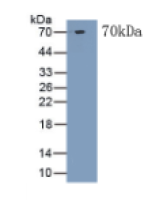 心肌肌钙蛋白T(TNNT2)单克隆抗体