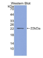甲状旁腺激素相关蛋白(PTHrP)单克隆抗体