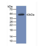 糖抗原19-9(CA19-9)单克隆抗体
