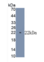 肌球蛋白重链7(MYH7)单克隆抗体