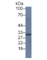 核因子κB受体激活因子配体(RANkL)单克隆抗体