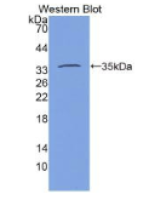 CD34分子(CD34)单克隆抗体